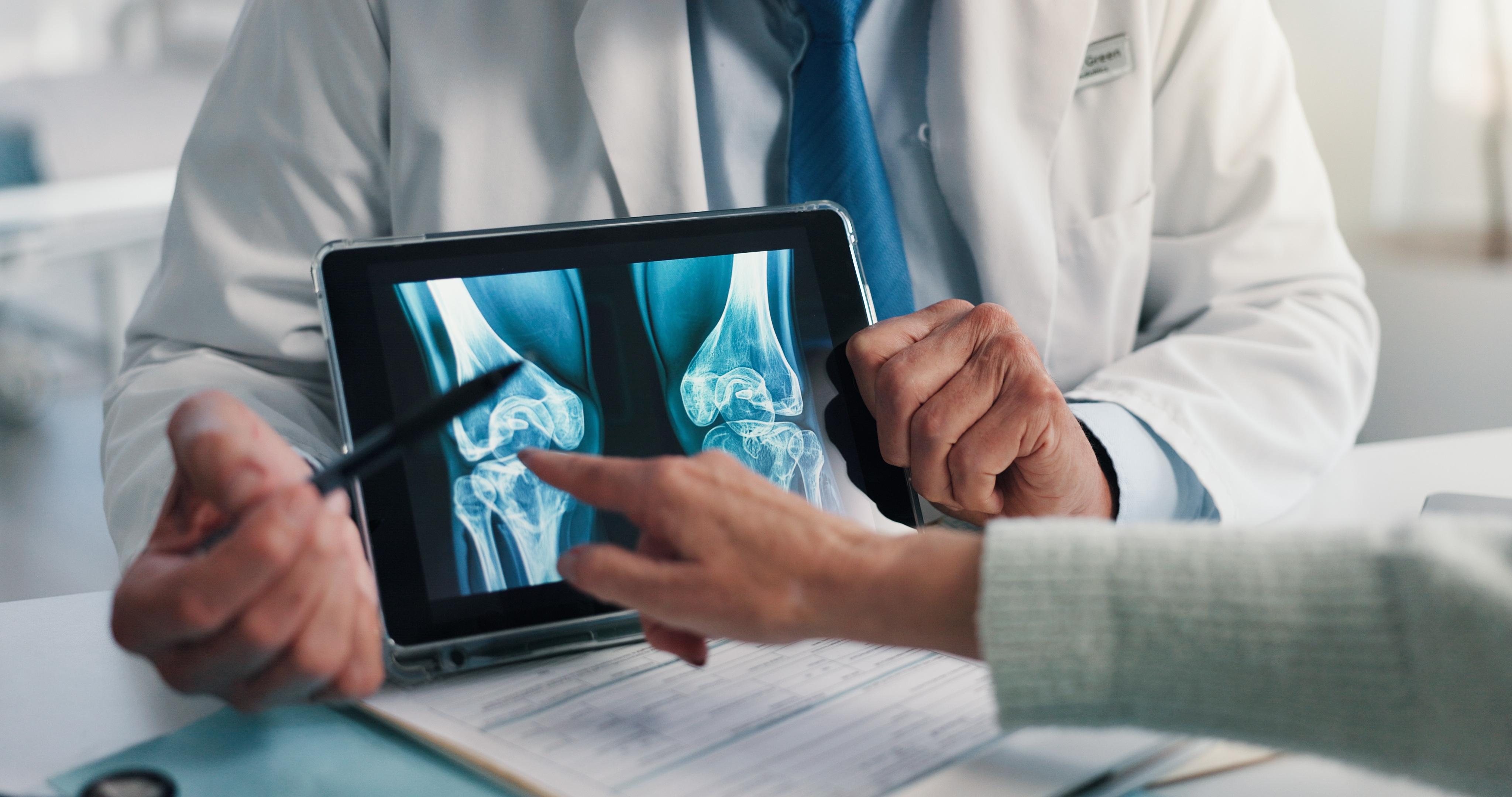 What Types of Arthritis Qualify You For Disability Benefits?